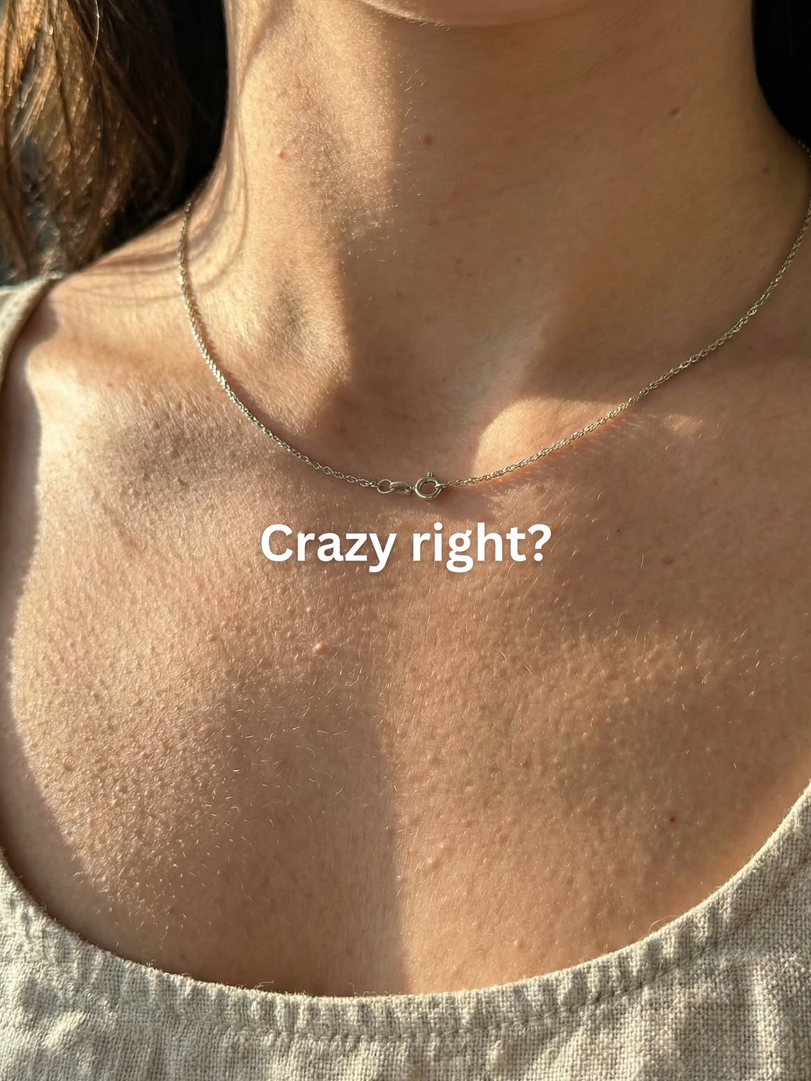 Crazy right? — natural skin on chest